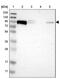 Catenin Delta 1 antibody, NBP2-38130, Novus Biologicals, Western Blot image 
