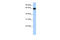 Zinc Finger Protein 100 antibody, 25-339, ProSci, Enzyme Linked Immunosorbent Assay image 