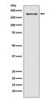 Histone-lysine N-methyltransferase NSD3 antibody, M05608, Boster Biological Technology, Western Blot image 