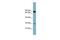 Cytochrome B5 Domain Containing 1 antibody, GTX45722, GeneTex, Western Blot image 