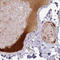 Apolipoprotein L1 antibody, AMAb90530, Atlas Antibodies, Immunohistochemistry paraffin image 