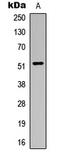 Aldehyde Dehydrogenase 3 Family Member B1 antibody, LS-C354522, Lifespan Biosciences, Western Blot image 