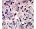 ALK Receptor Tyrosine Kinase antibody, F50548-0.4ML, NSJ Bioreagents, Immunohistochemistry frozen image 