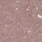 RUNX1 Partner Transcriptional Co-Repressor 1 antibody, NBP2-49644, Novus Biologicals, Immunohistochemistry paraffin image 