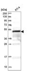 Zinc finger FYVE domain-containing protein 19 antibody, NBP2-58993, Novus Biologicals, Western Blot image 