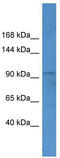 FtsJ RNA 2'-O-Methyltransferase 3 antibody, TA346787, Origene, Western Blot image 