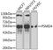 Proteasome 26S Subunit, Non-ATPase 4 antibody, A1061, ABclonal Technology, Western Blot image 