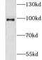 G Protein-Coupled Receptor Associated Sorting Protein 2 antibody, FNab03613, FineTest, Western Blot image 