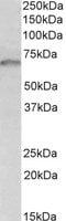 Growth Factor Receptor Bound Protein 10 antibody, MBS423361, MyBioSource, Western Blot image 