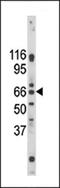 G Protein-Coupled Receptor 37 antibody, 62-274, ProSci, Western Blot image 