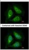 Phosphatidylinositol-5-Phosphate 4-Kinase Type 2 Alpha antibody, NBP2-19835, Novus Biologicals, Immunocytochemistry image 