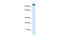 Early Endosome Antigen 1 antibody, 27-281, ProSci, Enzyme Linked Immunosorbent Assay image 