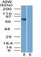 Sterile alpha and TIR motif-containing protein 1 antibody, NBP2-29625, Novus Biologicals, Western Blot image 