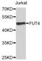 Fucosyltransferase 9 antibody, STJ111727, St John