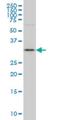 Family With Sequence Similarity 189 Member A2 antibody, H00009413-M01, Novus Biologicals, Western Blot image 