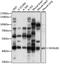 SH3 Domain Containing GRB2 Like, Endophilin B1 antibody, LS-C750131, Lifespan Biosciences, Western Blot image 