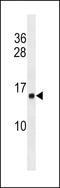 Histone Cluster 1 H2A Family Member M antibody, LS-C203732, Lifespan Biosciences, Western Blot image 
