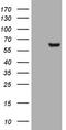 Matrix Metallopeptidase 3 antibody, LS-C340153, Lifespan Biosciences, Western Blot image 