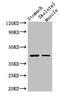 Angiotensin II type-1 receptor antibody, CSB-PA001465LA01HU, Cusabio, Western Blot image 