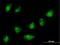 Zinc Finger Protein 576 antibody, H00079177-B01P, Novus Biologicals, Immunofluorescence image 