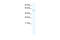 LAG1 longevity assurance homolog 4 antibody, 28-656, ProSci, Enzyme Linked Immunosorbent Assay image 