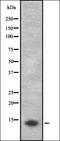 Kruppel Like Factor 14 antibody, orb335404, Biorbyt, Western Blot image 