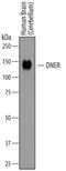 Delta/Notch Like EGF Repeat Containing antibody, AF3646, R&D Systems, Western Blot image 