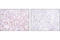 Signal Transducer And Activator Of Transcription 1 antibody, 8826S, Cell Signaling Technology, Immunohistochemistry paraffin image 