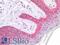 CD63 Molecule antibody, LS-A11976, Lifespan Biosciences, Immunohistochemistry paraffin image 