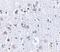 BR Serine/Threonine Kinase 1 antibody, NBP1-76778, Novus Biologicals, Immunohistochemistry paraffin image 