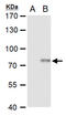 ERCC Excision Repair 2, TFIIH Core Complex Helicase Subunit antibody, GTX129284, GeneTex, Western Blot image 