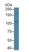 Oncostatin M Receptor antibody, LS-C295722, Lifespan Biosciences, Western Blot image 