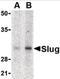 Snail Family Transcriptional Repressor 2 antibody, NB100-80828, Novus Biologicals, Western Blot image 