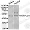 Homocysteine Inducible ER Protein With Ubiquitin Like Domain 1 antibody, A7048, ABclonal Technology, Western Blot image 