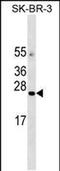 Angiotensin II Receptor Associated Protein antibody, PA5-49010, Invitrogen Antibodies, Western Blot image 