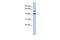 Olfactomedin Like 1 antibody, GTX45173, GeneTex, Western Blot image 