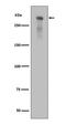 Protein Kinase, DNA-Activated, Catalytic Subunit antibody, P00645, Boster Biological Technology, Western Blot image 