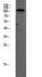 ATPase Na+/K+ Transporting Subunit Alpha 1 antibody, STJ99661, St John