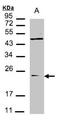 VPS29 Retromer Complex Component antibody, NBP1-30994, Novus Biologicals, Western Blot image 