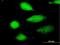 N-terminal EF-hand calcium-binding protein 2 antibody, H00054550-B01P, Novus Biologicals, Immunocytochemistry image 