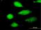 N-Terminal EF-Hand Calcium Binding Protein 2 antibody, H00054550-B01P, Novus Biologicals, Immunocytochemistry image 