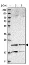 Phosphomevalonate Kinase antibody, NBP1-83142, Novus Biologicals, Western Blot image 