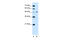 Carbohydrate Sulfotransferase 1 antibody, 30-071, ProSci, Western Blot image 