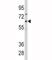 Cytochrome P450 Family 1 Subfamily B Member 1 antibody, F50866-0.4ML, NSJ Bioreagents, Western Blot image 