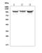 ADAM Metallopeptidase Domain 15 antibody, A02593-4, Boster Biological Technology, Western Blot image 