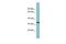 Surfactant Protein D antibody, GTX47151, GeneTex, Western Blot image 