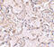 Glutathione S-Transferase Pi 1 antibody, 4413, ProSci, Immunohistochemistry paraffin image 