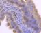 Integrin Subunit Alpha 5 antibody, NBP2-67883, Novus Biologicals, Immunohistochemistry paraffin image 