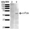 Fos Proto-Oncogene, AP-1 Transcription Factor Subunit antibody, LS-C777254, Lifespan Biosciences, Western Blot image 