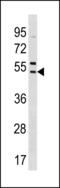 Sorting Nexin 5 antibody, LS-C203877, Lifespan Biosciences, Western Blot image 